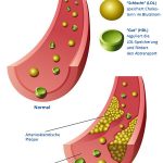 Gutes (HDL) und Schlechtes (LDL) Cholesterin